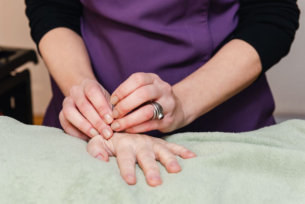 Applying Acupuncture technique 
